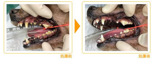 処置前/処置後